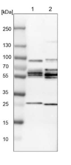 PHF24 Antibody, Novus Biologicals 0.1mL; Unlabeled:Antibodies, Polyclonal