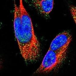 PHF24 Antibody, Novus Biologicals 0.1mL; Unlabeled:Antibodies, Polyclonal