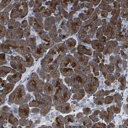 PHF24 Antibody, Novus Biologicals 0.1mL; Unlabeled:Antibodies, Polyclonal