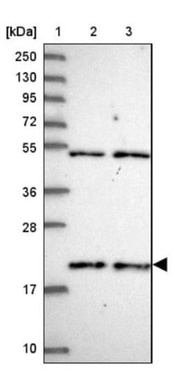 KIAA1143 Antibody, Novus Biologicals 0.1 mL | Buy Online | Novus Biologicals | Fisher Scientific