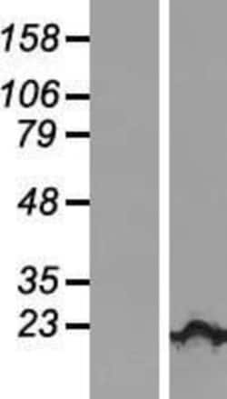 Novus Biologicals&trade;&nbsp;KIAA1143 Overexpression Lysate