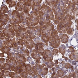 KIAA1143 Antibody, Novus Biologicals 0.1 mL | Buy Online | Novus Biologicals | Fisher Scientific
