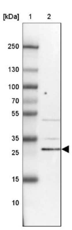 KIAA1257 Antibody, Novus Biologicals:Antibodies:Primary Antibodies