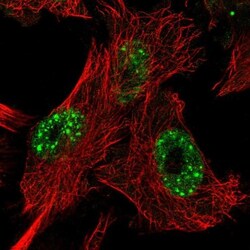 KIAA1257 Antibody, Novus Biologicals:Antibodies:Primary Antibodies