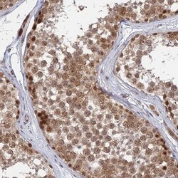 KIAA1257 Antibody, Novus Biologicals:Antibodies:Primary Antibodies