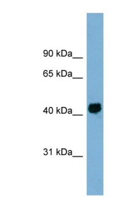 KIAA1704 Antibody, Novus Biologicals 100 &mu;L | Buy Online | Novus Biologicals | Fisher Scientific
