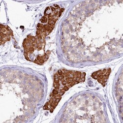 CEP295 Antibody, Novus Biologicals:Antibodies:Primary Antibodies