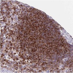 PPP1R18 Antibody, Novus Biologicals 0.1mL; Unlabeled:Antibodies, Polyclonal
