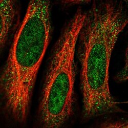 CCDC183 Antibody, Novus Biologicals 25 &mu;L, Unlabeled:Antibodies, Polyclonal