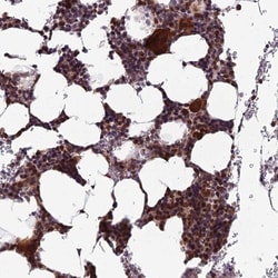 CCDC183 Antibody, Novus Biologicals 25 &mu;L, Unlabeled:Antibodies, Polyclonal