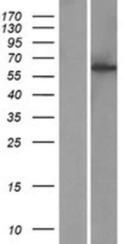 Novus Biologicals&trade;&nbsp;CCDC183 Overexpression Lysate