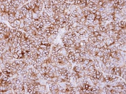 KIDINS220 Antibody, Novus Biologicals 0.1mg; Unlabeled:Antibodies, Polyclonal