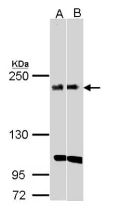 KIDINS220 Antibody, Novus Biologicals 0.1mg; Unlabeled:Antibodies, Polyclonal