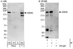 KIDINS220 Antibody, Novus Biologicals 0.1mg; Unlabeled:Antibodies, Polyclonal