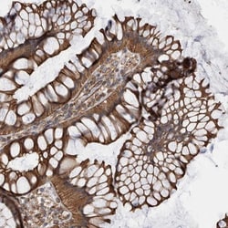 KIF12 Antibody, Novus Biologicals:Antibodies:Primary Antibodies