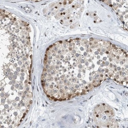 KIF15 Antibody, Novus Biologicals 25 &mu;L | Buy Online | Novus Biologicals | Fisher Scientific