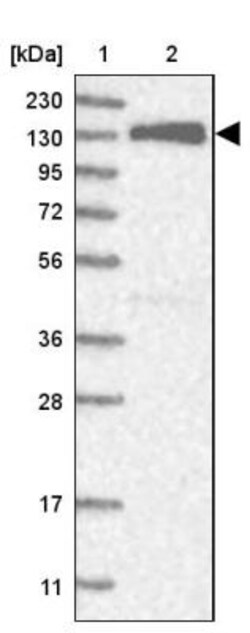 KIF15 Antibody, Novus Biologicals 0.1mL; Unlabeled:Antibodies, Polyclonal