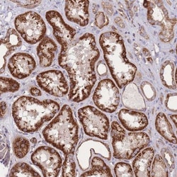 KIF16B Antibody, Novus Biologicals 0.1mL; Unlabeled:Antibodies, Polyclonal