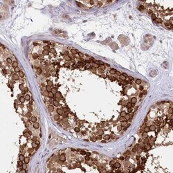 KIF17 Antibody, Novus Biologicals 0.1mL; Unlabeled:Antibodies, Polyclonal