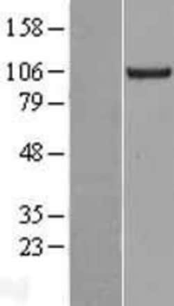 Novus Biologicals&trade;&nbsp;KIF18A Overexpression Lysate