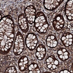 KIF18A Antibody, Novus Biologicals:Antibodies:Primary Antibodies