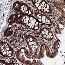 KIF18A Antibody, Novus Biologicals:Antibodies:Primary Antibodies