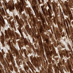 KIF1C Antibody, Novus Biologicals 0.1mL; Unlabeled:Antibodies, Polyclonal