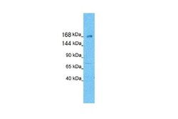 KIF21A Antibody, Novus Biologicals 0.05mg; Unlabeled:Antibodies, Polyclonal