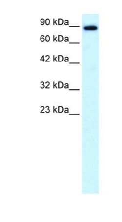 KIF21A Antibody, Novus Biologicals 0.05mg; Unlabeled:Antibodies, Polyclonal