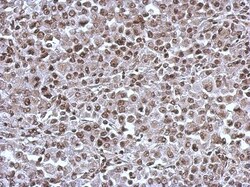 KIF22 Antibody, Novus Biologicals 0.1mL; Unlabeled:Antibodies, Polyclonal