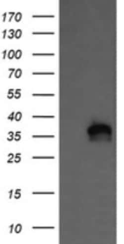 KIF25 Antibody (OTI2F4), Novus Biologicals 0.1mL; Unlabeled:Antibodies,