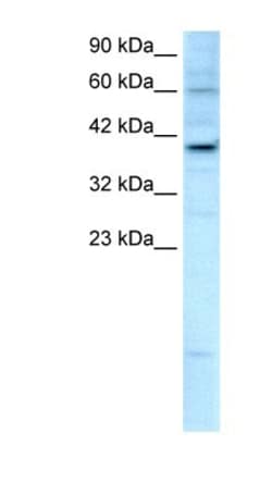 KIF25 Antibody, Novus Biologicals 100&mu;L; Unlabeled:Antibodies, Polyclonal