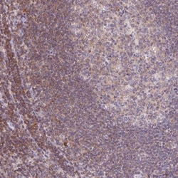 KIF26A Antibody, Novus Biologicals 25 &mu;L, Unlabeled:Antibodies, Polyclonal