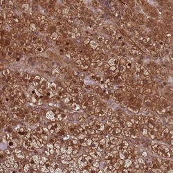 KIF26A Antibody, Novus Biologicals:Antibodies:Primary Antibodies