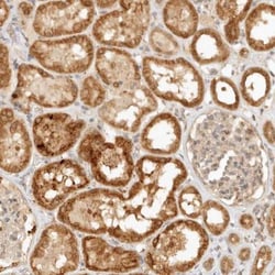 KIF2B Antibody, Novus Biologicals:Antibodies:Primary Antibodies