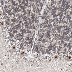 KIF2B Antibody, Novus Biologicals 0.1mL; Unlabeled:Antibodies, Polyclonal