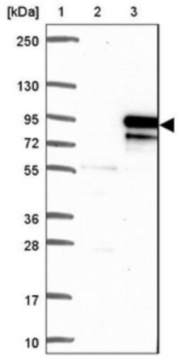 KIF2B Antibody, Novus Biologicals 25 &mu;L; Unlabeled:Antibodies, Polyclonal