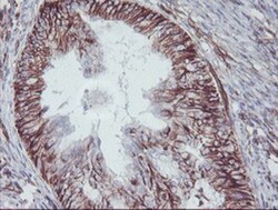 KIF2C Antibody (OTI1C5), Novus Biologicals 0.1mL; Unlabeled:Antibodies,