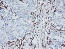 KIF2C Antibody (OTI1C5), Novus Biologicals 0.1mL; Unlabeled:Antibodies,