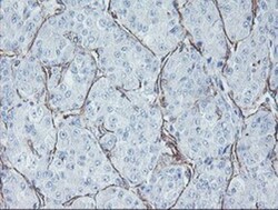 KIF2C Antibody (OTI1C5), Novus Biologicals 0.1mL; Unlabeled:Antibodies,