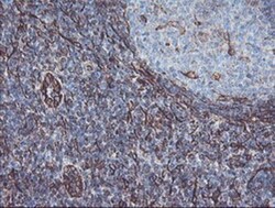KIF2C Antibody (OTI1C5), Novus Biologicals 0.1mL; Unlabeled:Antibodies,