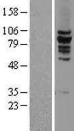 Novus Biologicals&trade;&nbsp;KIF2C Overexpression Lysate