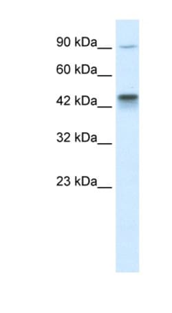 KIF3A Antibody, Novus Biologicals 100&mu;L; Unlabeled:Antibodies, Polyclonal