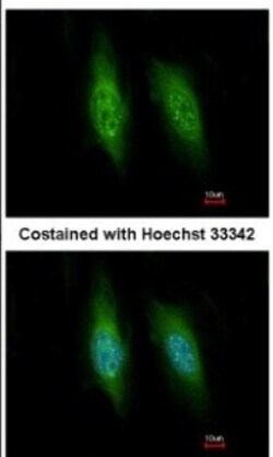 KIFC3 Antibody, Novus Biologicals™