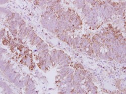 KIFC3 Antibody, Novus Biologicals 0.1mL; Unlabeled:Antibodies, Polyclonal