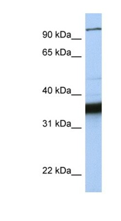 KIFC3 Antibody, Novus Biologicals 100&mu;L; Unlabeled:Antibodies, Polyclonal
