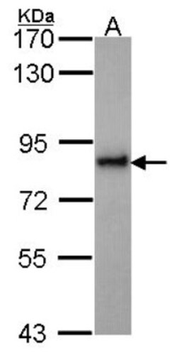 KIFC3 Antibody, Novus Biologicals 0.1mL; Unlabeled:Antibodies, Polyclonal