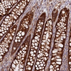 Kindlin Antibody, Novus Biologicals:Antibodies:Primary Antibodies
