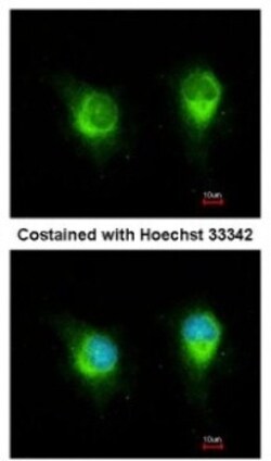 kinectin Antibody, Novus Biologicals 0.1mL; Unlabeled:Antibodies, Polyclonal