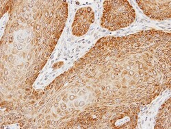 kinectin Antibody, Novus Biologicals 0.1mL; Unlabeled:Antibodies, Polyclonal